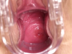 Inside Scarlett - endoscopic vaginal exam of pink vagina